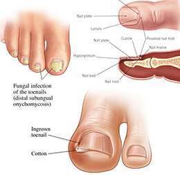 Doctor Formulation